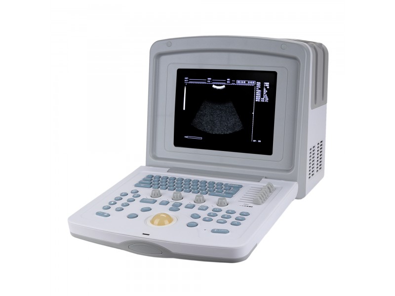 УЗИ сканер Med-Mos CMS600B3