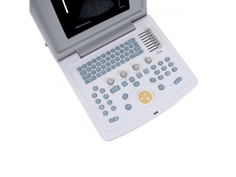 УЗИ сканер Med-Mos CMS600B3