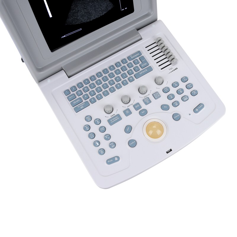 УЗИ сканер Med-Mos CMS600B3