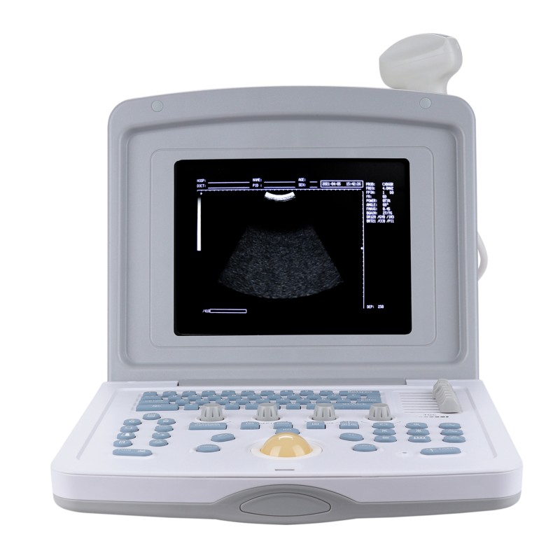 УЗИ сканер Med-Mos CMS600B3