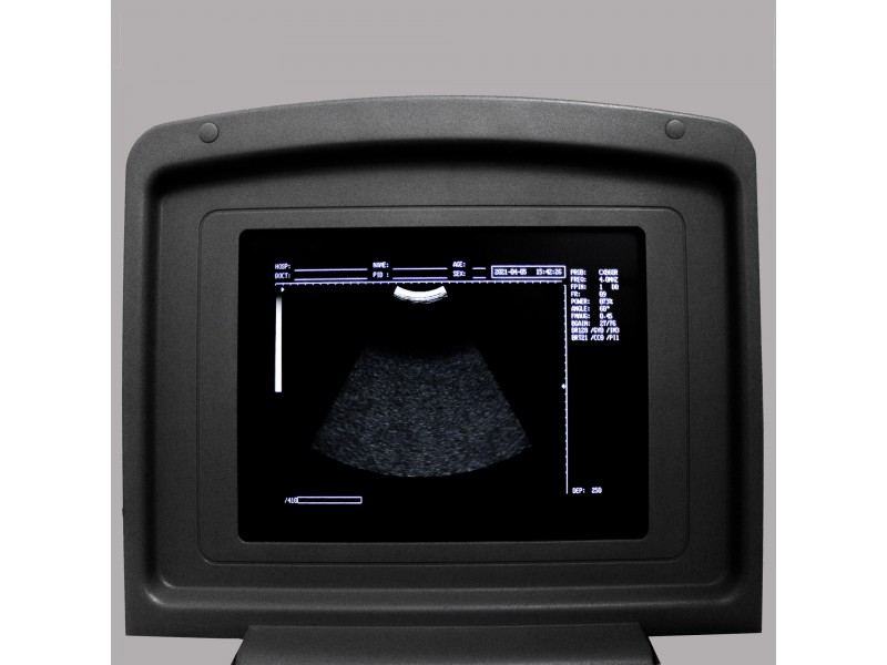 УЗИ сканер Med-Mos CMS600B3